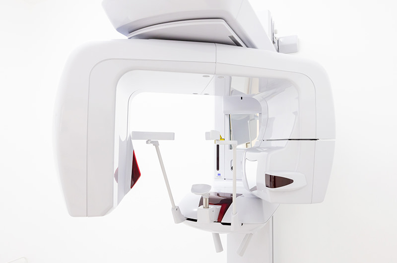 歯科用CT（デジタルレントゲン）